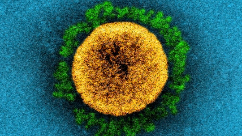 Covid-19:オミクロンの新型イテレーション「BA.2」が台頭