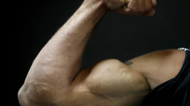 フランスで成長する「男性主義者」文化は、性差別との戦いを遅らせる